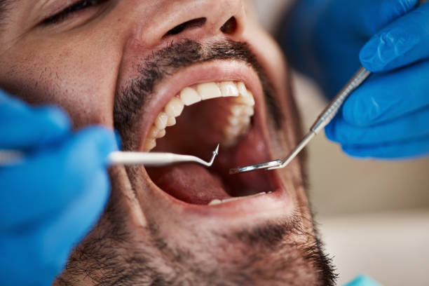 Emergency Dental Services in Terrace Heights, WA